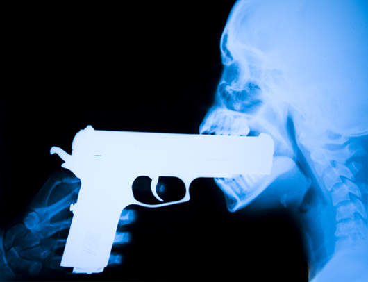 驚悚X光照 別把這麼大一根給塞進去 驚悚X光照 別把這麼大一根給塞進去