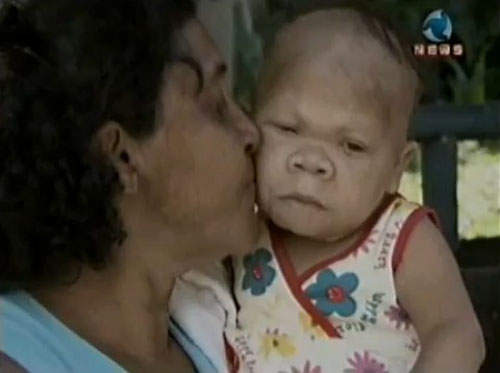 30歲不老嬰兒 9個月的外表 班傑明真實版? 30歲不老嬰兒 9個月的外表 班傑明真實版?