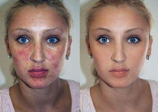 素顏前後差很大特輯之〝超神ps〞技巧大公開 第三彈 素顏前後差很大特輯之〝超神ps〞技巧大公開 第三彈