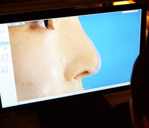 再也不用害怕整形失敗!?模擬整形後的3D機器登場! 再也不用害怕整形失敗!?模擬整形後的3D機器登場!