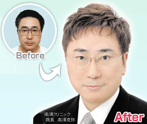 整形診所統計!!「大家最想整型成的男星」Top10 整形診所統計!!「大家最想整型成的男星」Top10