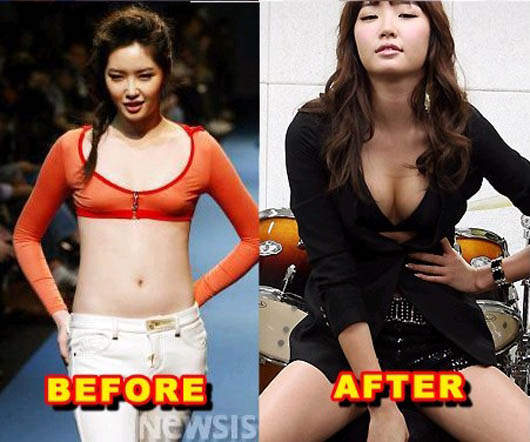 韓星的胸部 Before&amp;After