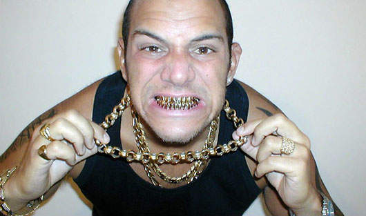 Bling Bling 的鑲鑽牙套