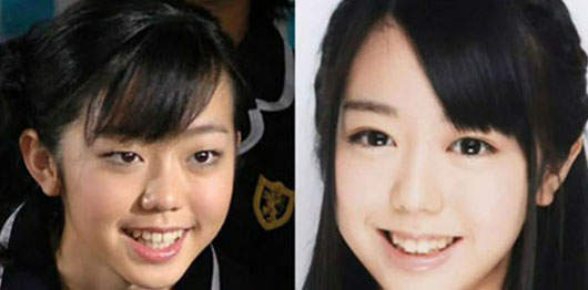 日本流行全臉整型?! 日本流行全臉整型?!