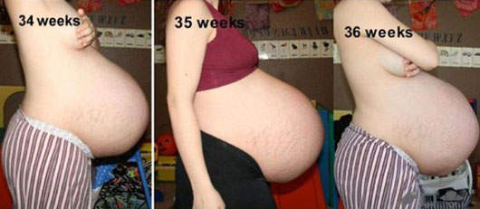 媽媽真的很偉大　三胞胎的懷孕過程