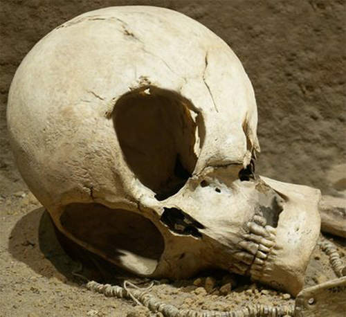 WTF on Mars!火星上又發現死人骨頭了? WTF on Mars!火星上又發現死人骨頭了?