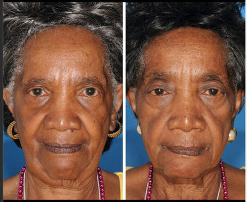 吸煙影響老化嗎?看看雙胞胎的變化就知道~ 吸煙影響老化嗎?看看雙胞胎的變化就知道~