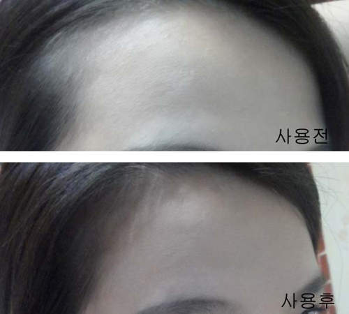 高額頭救星《髮際陰影膏》人家不想當清朝人了啦～