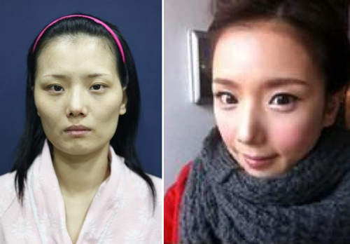 《自然風整形實錄》？這樣真的有比較自然⊙＿⊙？