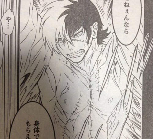 《青年怪醫黑傑克》日本新版漫畫有夠逼－－老闆給我來十本（拍桌）