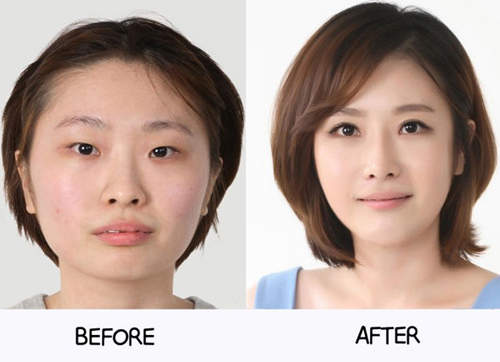 《整形before&after》特輯　有些根本不需要動刀吧......