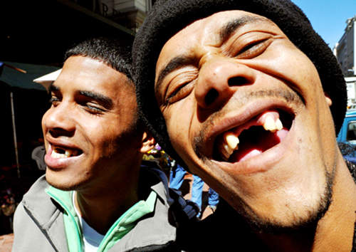 《無齒微笑》超流行！沒有門牙的笑容才叫潮～！？