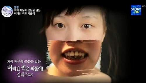 韓《黑牙妹大改造》妳終於能露出久違的笑容了ಥ_ಥ 韓《黑牙妹大改造》妳終於能露出久違的笑容了ಥ_ಥ