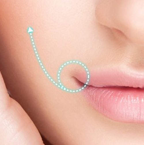 韓國最新《嘴角上揚整形術》以後想哭就只能唱........ 韓國最新《嘴角上揚整形術》以後想哭就只能唱........