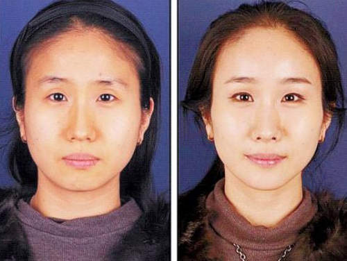 韓妞立馬美《整形化妝術》不用動刀也有臥蠶和微笑嘴角?! 韓妞立馬美《整形化妝術》不用動刀也有臥蠶和微笑嘴角?!