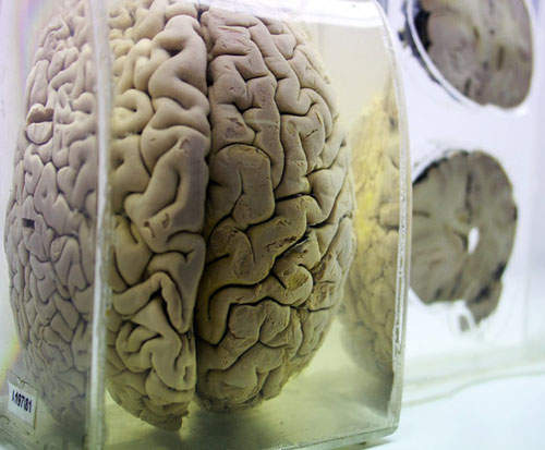 印度大腦博物館　一個腦~兩個腦~三個腦~四個腦．．．