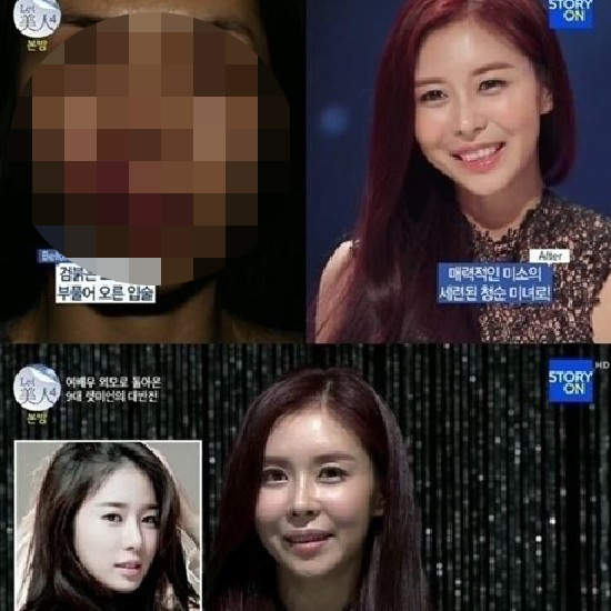 《搶救半臉女》終於可以正面大方示人啦~ 《搶救半臉女》終於可以正面大方示人啦~