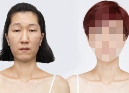 韓《老臉女大變身》整形費用高達9477萬韓元！！