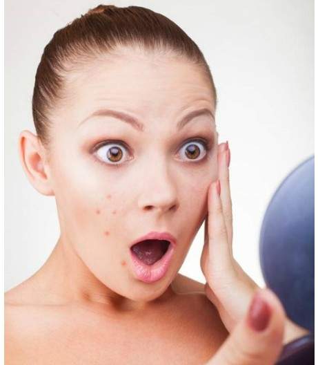 《痘痘位置》讓人抓狂的五大部位是…? 《痘痘位置》讓人抓狂的五大部位是…?
