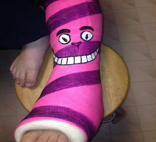 《人生勝利組》就算上石膏也要搞得很歡樂 《人生勝利組》就算上石膏也要搞得很歡樂