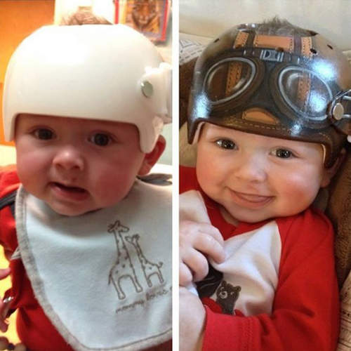 超可愛《北鼻矯正頭盔》我的安全帽也這麼可愛就好了❤