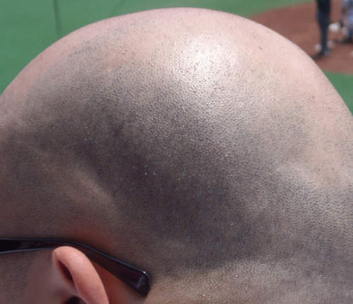 禿頭的好處　日本網友超心酸的重點分析