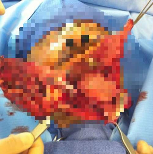 【閱覽注意】《Instagram人體解剖記錄》可、可以整篇都馬賽克嗎?(哭) 【閱覽注意】《Instagram人體解剖記錄》可、可以整篇都馬賽克嗎?(哭)