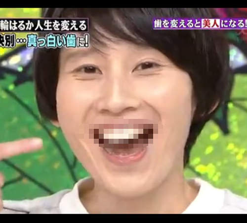 《針千本箕輪遙》門牙大改造　以後就不能拿這搞笑惹ww