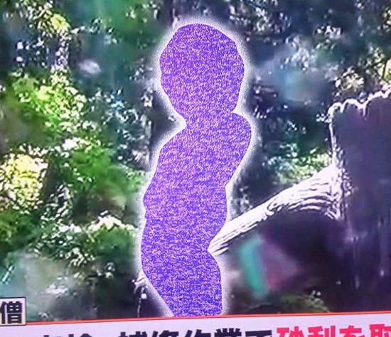 《尿尿小童軟趴趴》尿道結石手術後激昂的大暴射 《尿尿小童軟趴趴》尿道結石手術後激昂的大暴射