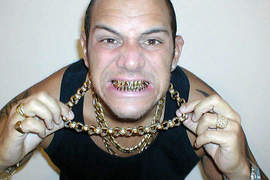 Bling Bling 的鑲鑽牙套 Bling Bling 的鑲鑽牙套