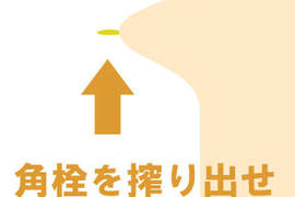 《粉刺達人app》讓擠粉刺也可以是練功的一種! 《粉刺達人app》讓擠粉刺也可以是練功的一種!