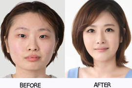 《整形before&after》特輯 有些根本不需要動刀吧...... 《整形before&after》特輯 有些根本不需要動刀吧......