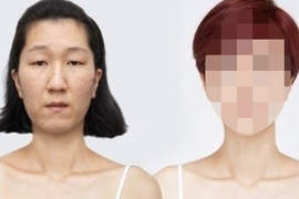 韓《老臉女大變身》整形費用高達9477萬韓元!! 韓《老臉女大變身》整形費用高達9477萬韓元!!