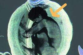 好可怕系列《把人類當養份吃的植物》居然很多人都想自願是怎麼回事 好可怕系列《把人類當養份吃的植物》居然很多人都想自願是怎麼回事