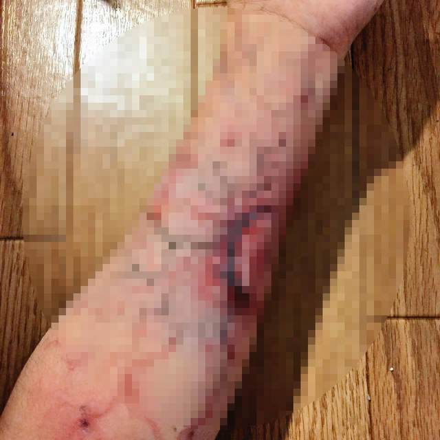 閱覽注意《被陌生人咬到的結果》驚悚推文難道是活屍病毒的擴散!? 閱覽注意《被陌生人咬到的結果》驚悚推文難道是活屍病毒的擴散!?
