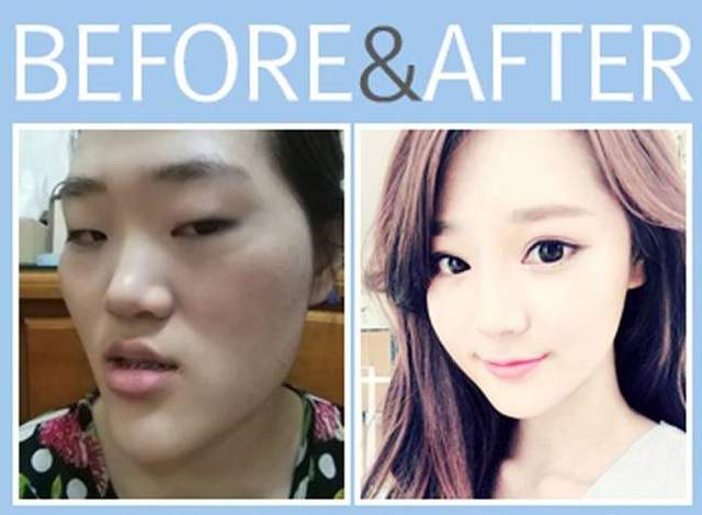 史上最強《整形照特輯》這真的是同一個人嗎？