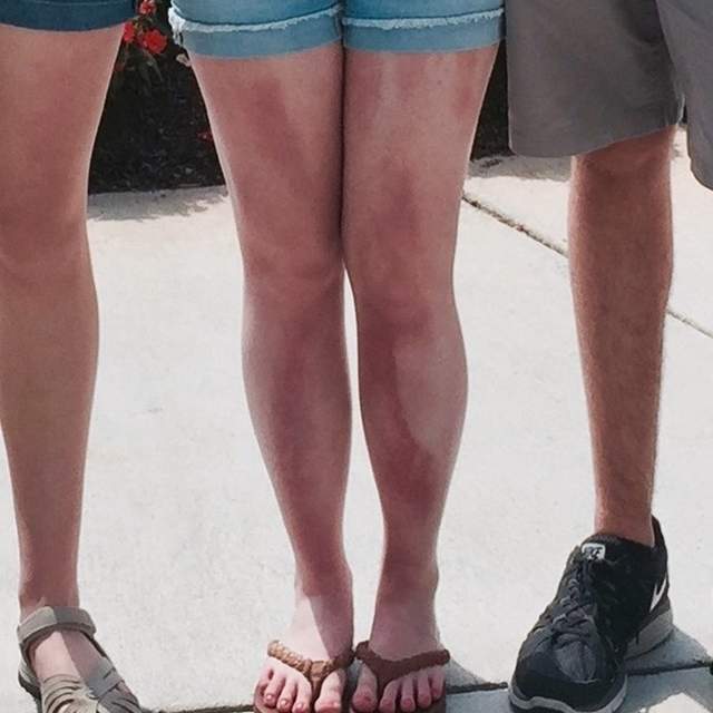 真人分享《防曬沒塗均勻的下場》能曬出虎斑紋也是一絕惹 真人分享《防曬沒塗均勻的下場》能曬出虎斑紋也是一絕惹