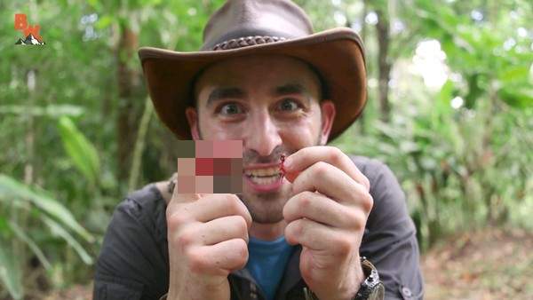 流血注意《切葉蟻咬手指》牙齒好像很利那來給他咬咬看好了(?) 流血注意《切葉蟻咬手指》牙齒好像很利那來給他咬咬看好了(?)