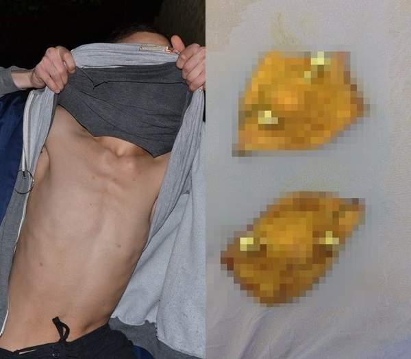 閱覽注意《乳頭耳環》用自己的乳頭製作還要拿來販賣...... 閱覽注意《乳頭耳環》用自己的乳頭製作還要拿來販賣......