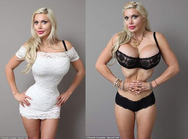 J罩杯《美女子拔肋骨整眼球》因為她想變成動漫人物… J罩杯《美女子拔肋骨整眼球》因為她想變成動漫人物…