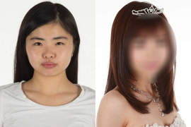 日本舉辦《整形選美大賽》參賽者術後究竟會有多大的變化? 日本舉辦《整形選美大賽》參賽者術後究竟會有多大的變化?