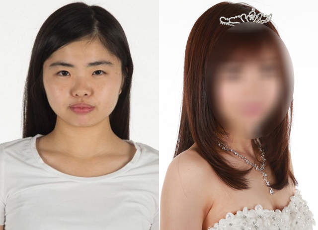 日本舉辦《整形選美大賽》參賽者術後究竟會有多大的變化? 日本舉辦《整形選美大賽》參賽者術後究竟會有多大的變化?