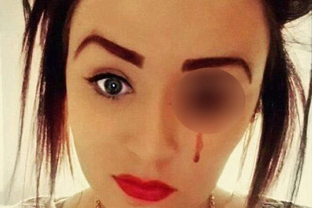 好可怕系列《英國血淚少女》眼睛和耳朵總是不停流血...