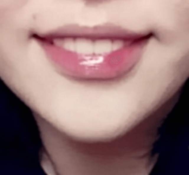 被挨轟是《最浪費錢的整形項目》事隔多年網友火力不減 被挨轟是《最浪費錢的整形項目》事隔多年網友火力不減