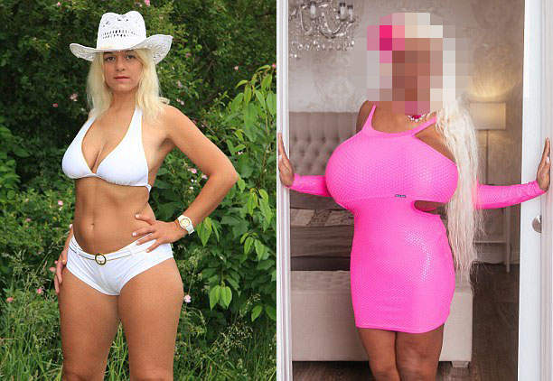 整形上癮《歐洲第一巨乳》比S罩杯還要驚人的改變是..... 整形上癮《歐洲第一巨乳》比S罩杯還要驚人的改變是.....