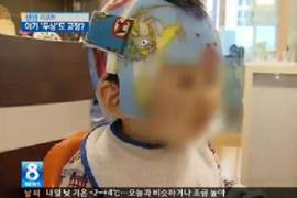 韓國媽媽《從嬰兒時期就開始追求美麗》每天都要戴23小時以上的頭盔生活...... 韓國媽媽《從嬰兒時期就開始追求美麗》每天都要戴23小時以上的頭盔生活......