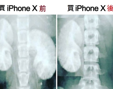 果粉不要看《一般網友對新哀鳳反應》奇怪腎怎麼少了一顆? 果粉不要看《一般網友對新哀鳳反應》奇怪腎怎麼少了一顆?
