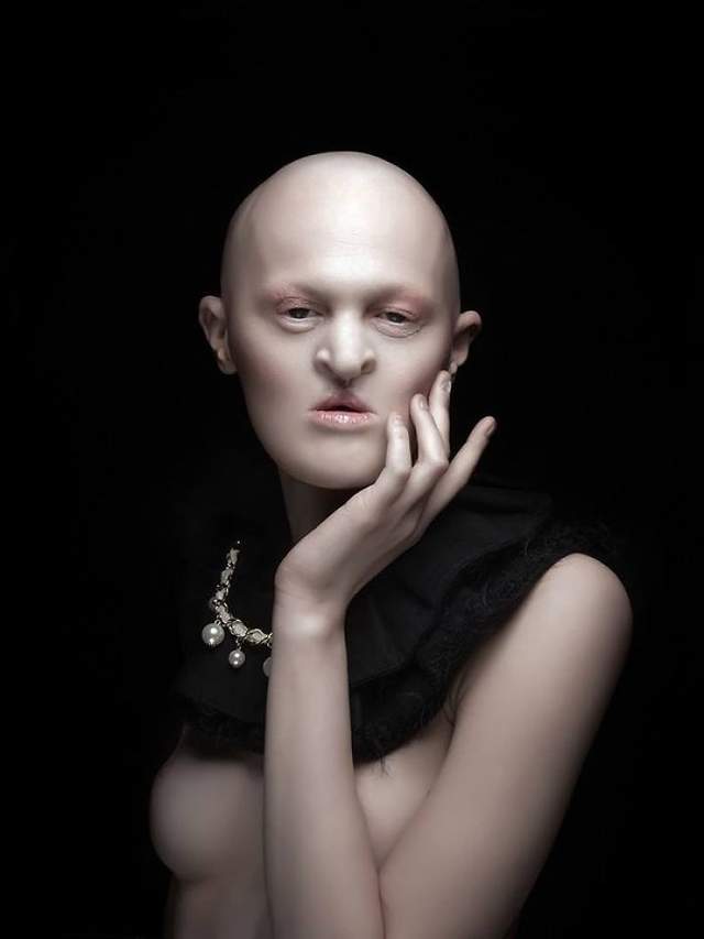 《罕病模特兒 Melanie Gaydos》短少毛髮與牙齒仍然顯現自大漂亮 - 圖片2