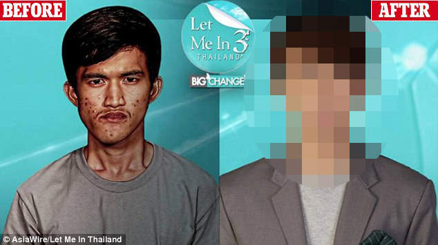 泰國歪臉男《整形整到媽媽都認不出來》可是媽媽感動到哭了... 泰國歪臉男《整形整到媽媽都認不出來》可是媽媽感動到哭了...