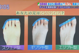 推特話題《從腳型選適合的鞋子》你的腳趾是羅馬、希臘還是埃及型? 推特話題《從腳型選適合的鞋子》你的腳趾是羅馬、希臘還是埃及型?